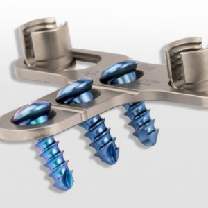 PORTHOS POSTERIOR CERVICAL SPINAL FIXATION SYSTEM - Img 2