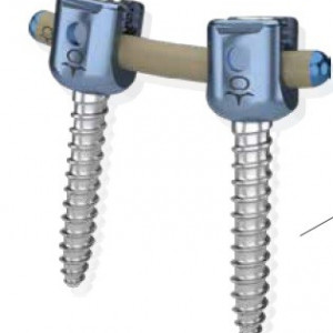 Sistem de Fixare Spinală Posterioră – Soluție Modulară pentru Traumă și Oncologie
