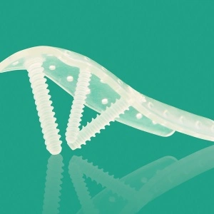 Sistem osteosinteză bioresorbabil Inion Freedom™ | Plăci și șuruburi interblocabile