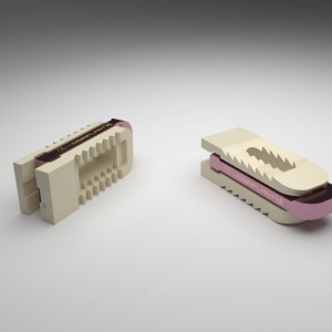 ARIA – Cage Vertebral PLIF Expandabil din PEEK și Titan | Fuziune Lombară Posterioară