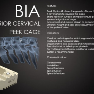 Hernie de Disc Cervicala, Cage Cervical din PEEK Bia