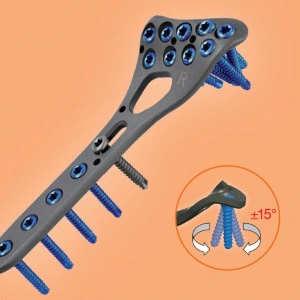 Placa de Radius Distal poliaxiala pentru osteointeza fracturii de radius 