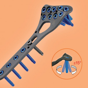Placa de Radius Distal poliaxiala pentru osteointeza fracturii de radius 