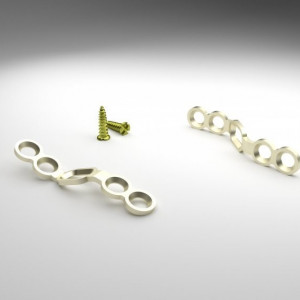 ULTIO LAMINOPLASTY POSTERIOR CERVICAL SPINAL FIXATION SYSTEM