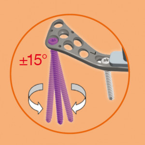 Placa de tibie proximala poliaxiala pentru osteosinteza fracturii de tibie Enlife