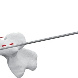 TRIPOD-FIX – Sistem Expandabil Vertebral pentru Fracturi de Compresie | Augmentare cu PMMA - Img 2