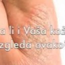 Staroplaninski melem za ekceme