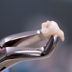 Dentina autologă în augmentări osoase: ghid clinic complet 2026