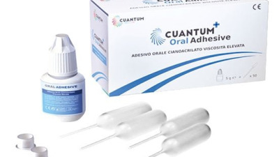Biocompatibilitatea adezivului de țesut cianoacrilat în combinație cu o membrană de colagen, un studiu Dr. Nevins