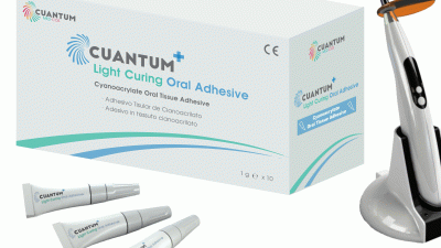 Inovație Controlată: Utilizarea Cuantum Light Curing Oral Adhesive pentru Proceduri Chirurgicale Avansate
