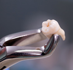 Dentina autologă în augmentări osoase: ghid clinic complet 2026