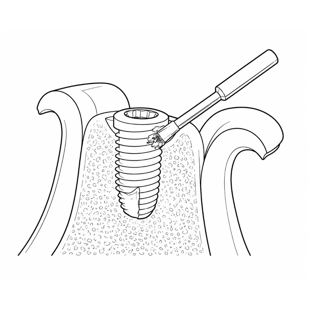 TI-BRUSH (Titanium Brush)