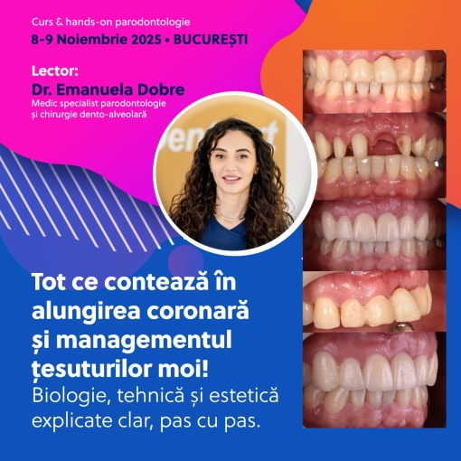 Tot ce Contează în Alungirea Coronară și Managementul Țesuturilor Moi