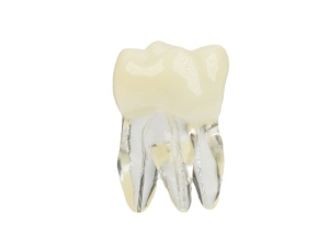 Dinte pentru practică – molar maxilar 26, simulare preclinică