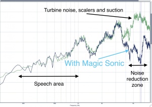 Magic Sonic 2 - Reductor de zgomote stridente - Img 6