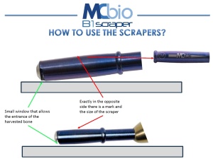 Bone Scraper Angulat MC Bio Surgery cu Mâner Ti + Lame M (Ø6mm) / XL (Ø8mm) - Recoltare Os Autolog - Img 3