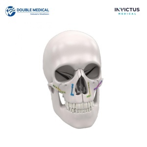 Placă curbă pentru split sagital (BSSO), 6 găuri, 1,0 mm, titan – Double Medical