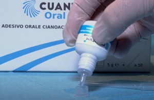 Cuantum Oral Adhesive – Adeziv Tisular Cianoacrilat Autopolimerizabil pentru Chirurgie Orală și Hemostază, 5g - Img 2