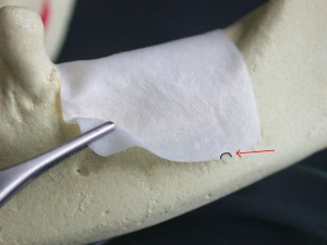 EXAFLEX – membrană resorbabilă din pericard bovin bilayer pentru regenerare osoasă ghidată (GBR/GTR), 25 x 25 x 0.2 mm - Maggi - Img 6