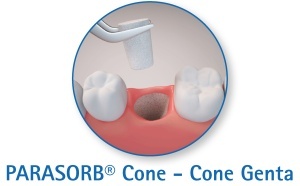 RESORBA PARASORB® Cone Genta MK10 – conuri hemostatice resorbabile din colagen cu gentamicină pentru alveola post-extracțională (10 buc.) - Img 3