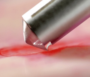 Bone Scraper Angulat MC Bio Surgery cu Mâner Ti + Lame M (Ø6mm) / XL (Ø8mm) - Recoltare Os Autolog - Img 4