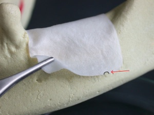 Pachet PLUS 3 x Membrane Resorbabile EXAFLEX - Img 4