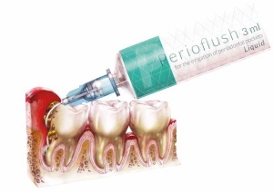 Perio-Flush Kit ( 10 × 3 ml ) – Soluție profesională pentru irigarea pungilor parodontale - ARKONA - Img 7