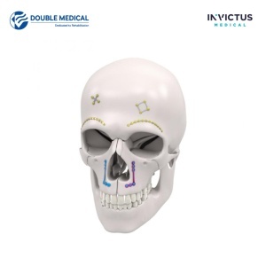 Placă cadru KALEIDO Midface 1,5, titan – Double Medical