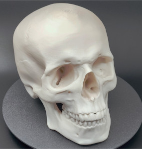 Craniu uman, scanat și printat 3D - Img 4