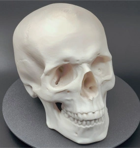 Craniu uman, scanat și printat 3D - Img 4