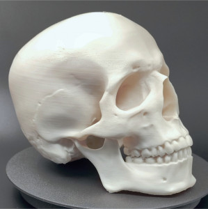 Craniu uman, scanat și printat 3D - Img 6