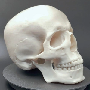 Craniu uman, scanat și printat 3D - Img 6