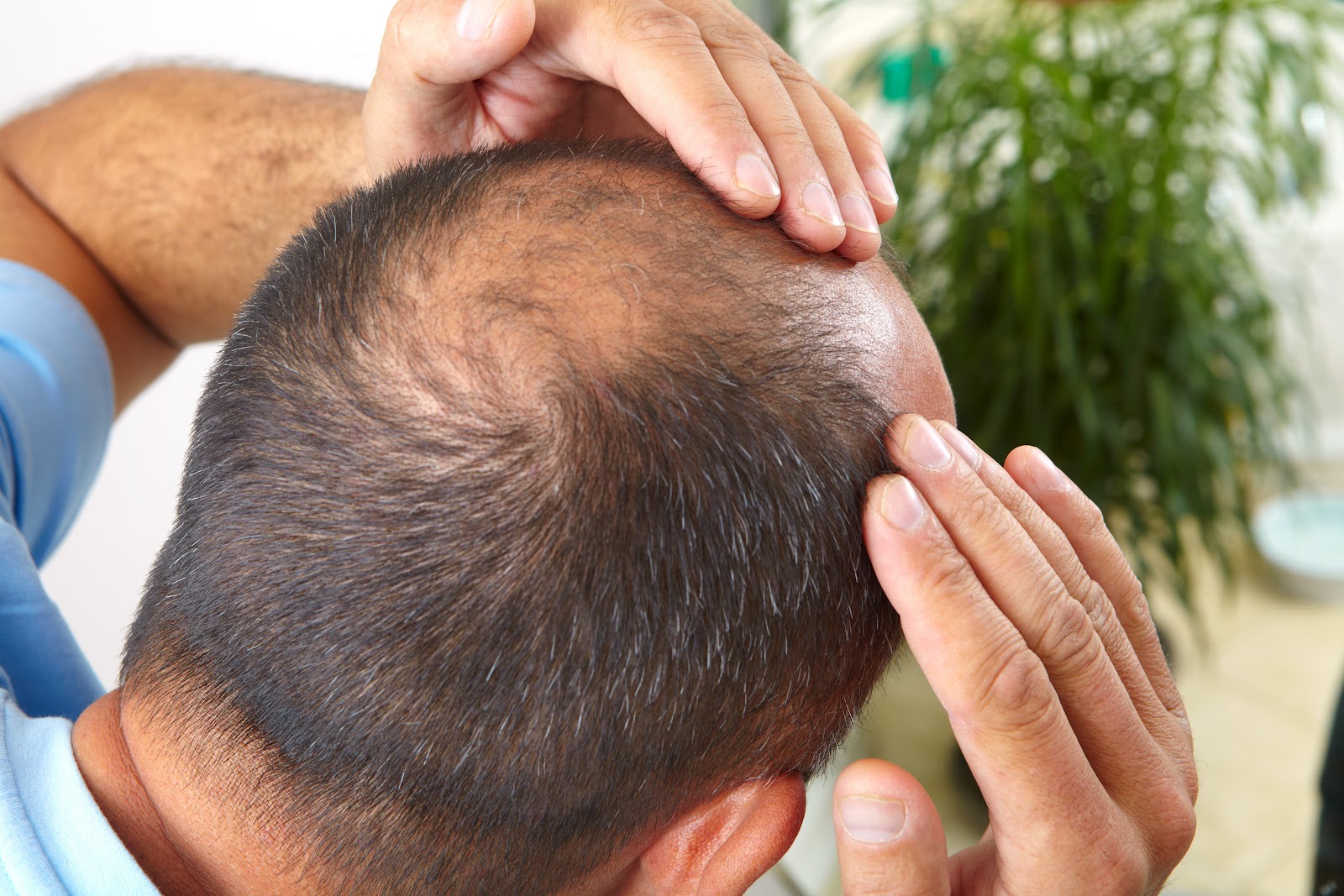 Probleme scalp