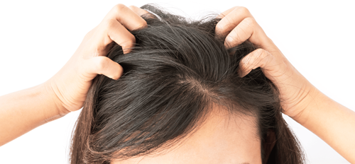 Scalp sensibil