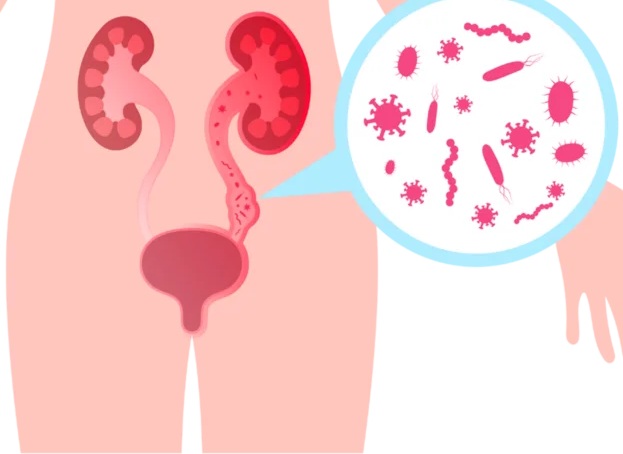 Tract Urinar
