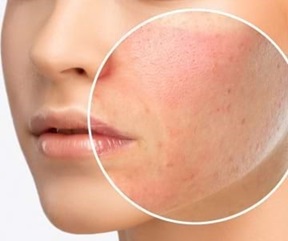 Afectiuni dermatologice