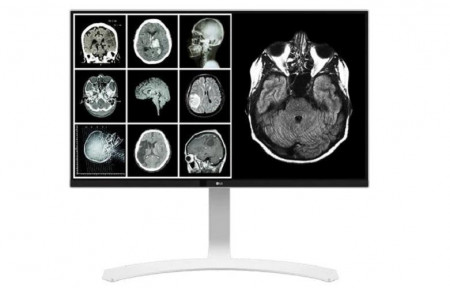 Monitor 27" LG 27HJ712C-W.AEU 8MP Clinical Review, Panel Type: IPS ,Resolution: 3840x2160, Brightness: 350cd/m2, Response Time: 14 ms,Contrast Ratio (typical): 1000:1, Connectivity: HDMI(2.0) x 2 ,DP(1.2) x1, Headphone Out, 1x USB 3.0 upstream, 2x USB