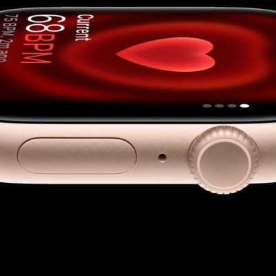 Apple Watch Series 11 GPS + Cellular 42mm Rose Gold Aluminium Case with Light Blush Sport Band - M/L - Img 2