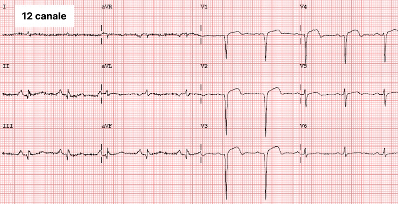 Electrocardiograma cu 12 canale - Medicalcorp.ro