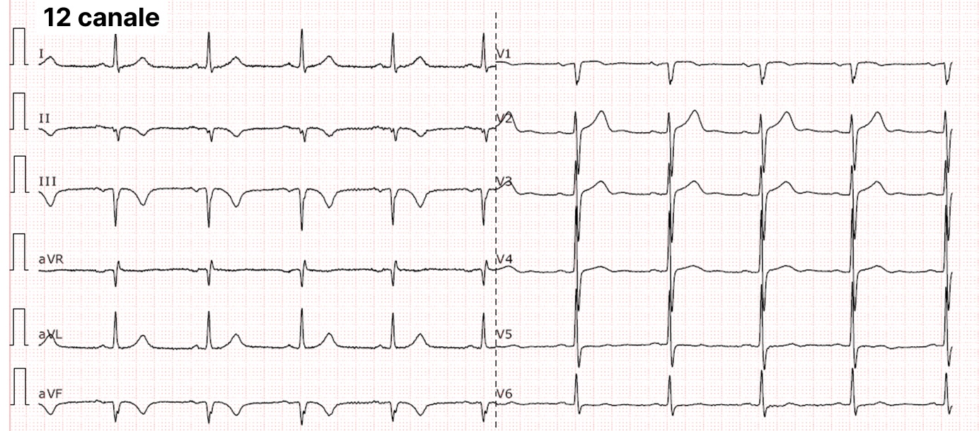 Electrocardiograma cu 12 canale - Medicalcorp.ro