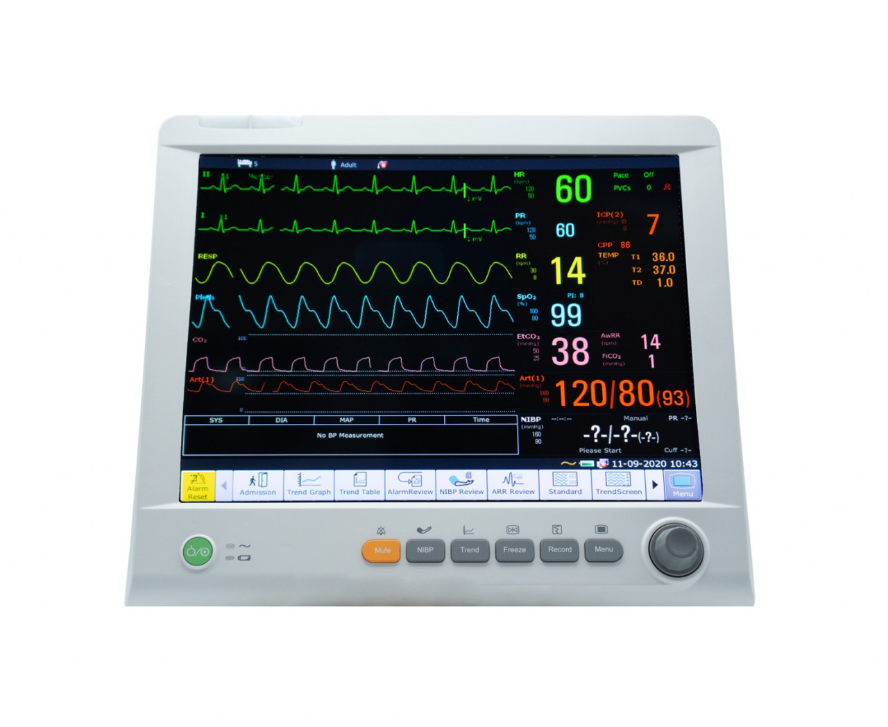 iX15 patient monitor EDAN