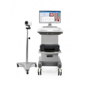 C6 HD video colposcope EDAN