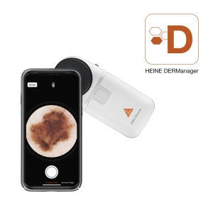 Dermatoscop alb HEINE DELTAone - exemplu de conectare cu iOS - Medicalcorp.ro