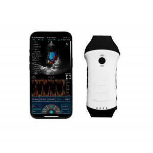 Ecograf C10HL ultraportabil cap dual - phased array și liniar - comparatie marime cu telefonul - Medicalcorp.ro