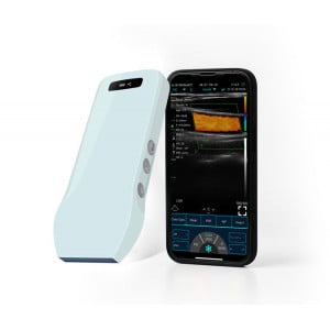 Ecograf C10CX ultraportabil cap liniar - exemplu de afisare pe telefon - Medicalcorp.ro