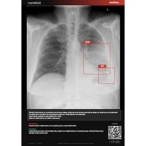 Diagnostic Software Radiology - CAREBOT AI CXR