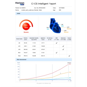 Software diagnostic HORIZON by CAREBOT AI CT LUNGS - Img 2