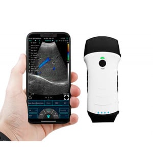 Ecograf C10XL ultraportabil cap dual - convex și liniar - afisare pe mobil - disponibil pe comanda la Medicalcorp.ro