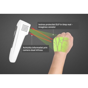 Iluminator vene Enmind VV-100 - functionare - Medicalcorp.ro