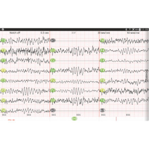 Mitsar-EEG-BT Lite QEEG ediție cu 32 de canale